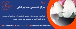 برای دندان‌های فاصله‌دار کامپوزیت بهتر است یا لمینت