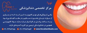 کامپوزیت دندان چیست