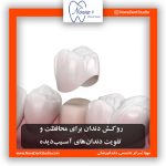 روکش دندان برای محافظت و تقویت دندان‌های آسیب‌دیده