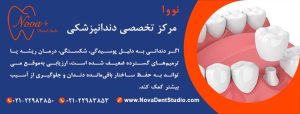روکش دندان در دندانپزشکی نووا
